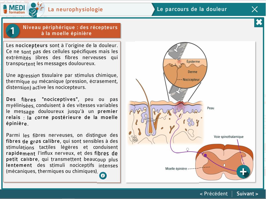 La plateforme